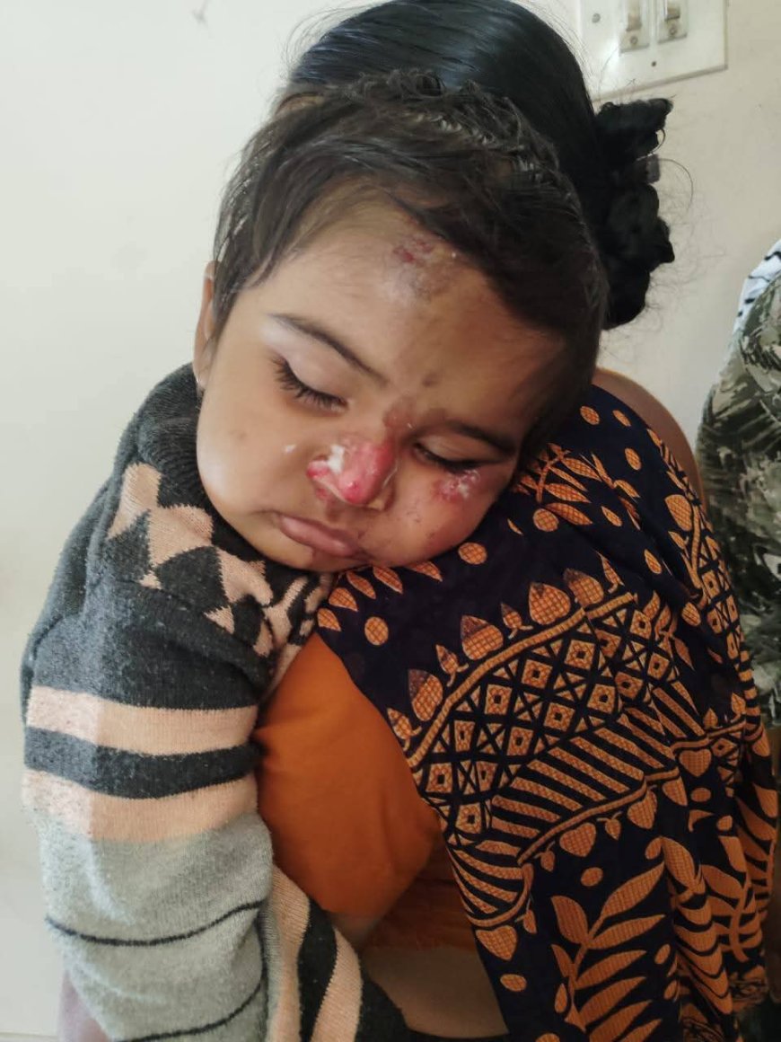 ಬೈಕ್ ನಲ್ಲಿ ತೆರಳುತ್ತಿದ್ದ ದಂಪತಿ ಮೇಲೆ ಚಿರತೆ ಅಟ್ಯಾಕ್...ಮಗು ಸೇರಿ ಮೂವರಿಗೆ ಗಂಭೀರ ಗಾಯ...